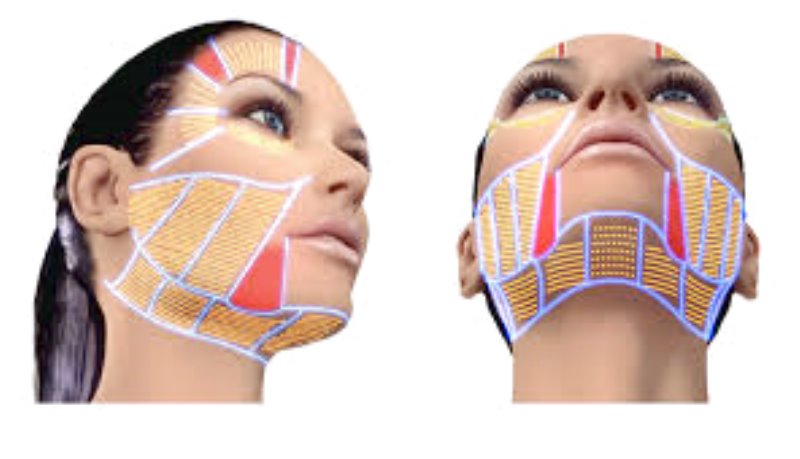 ULTHERA: dagli USA l’ultima frontiera per il lifting non chirurgico di viso e corpo