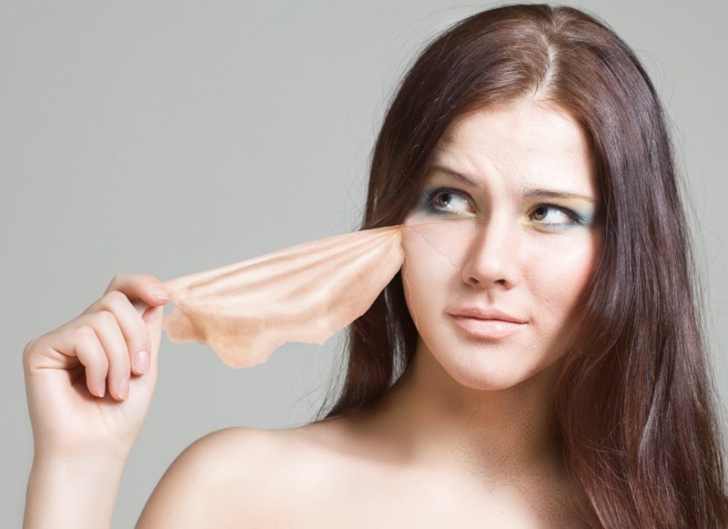 MESO.-NEEDLING: la nuova tecnica per la rivitalizzazione della pelle