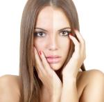Il laser che cancella macchie  tatuaggi e trucco permanente  indesiderati!